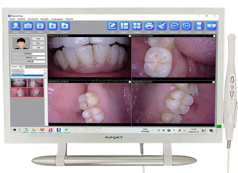 Magenta YF-2200P+ Dental 21.5 Inch Touch Screen Intraoral Camera VGA+HDMI